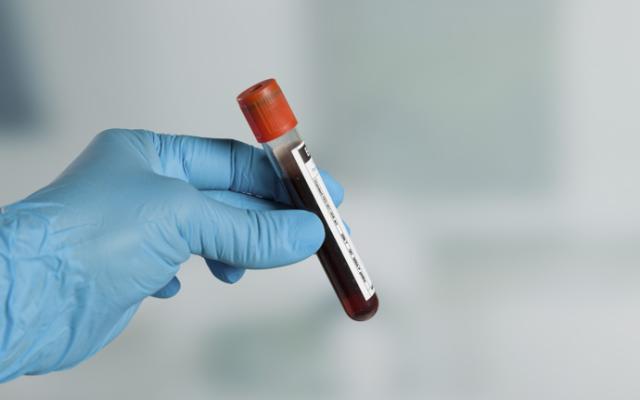 Análisis de RDW en sangre 