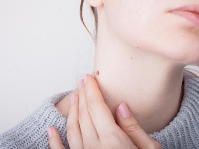 Métodos naturales para eliminar verrugas en el cuello.