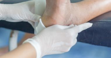 médico trata pie diabético